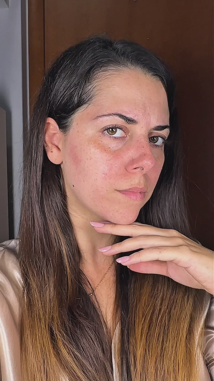 Siero Viso Purificante Antiage con Acido Salicilico e Acido Ialuronico – Beauxury Milano 30ml