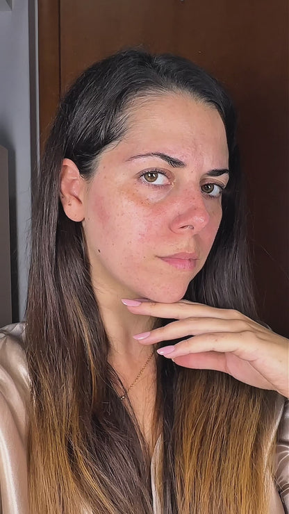 Siero Viso Purificante Antiage con Acido Salicilico e Acido Ialuronico – Beauxury Milano 30ml
